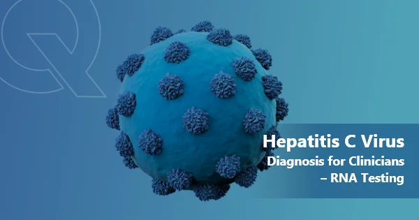 Hepatitis C Virus Diagnosis for Clinicians – RNA Testing