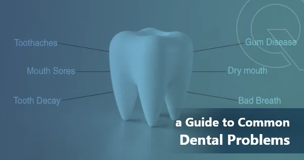 A Guide To Common Dental Problems