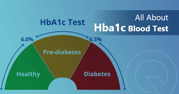 All about HbA1c Blood Test