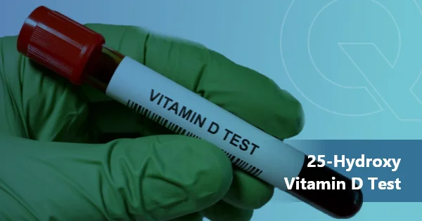 25-Hydroxy Vitamin D Test