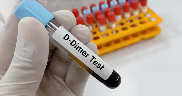 What is a D-dimer test?