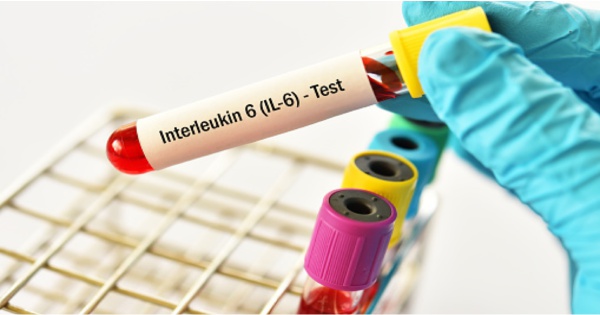 Interleukin-6 ( IL-6) Test