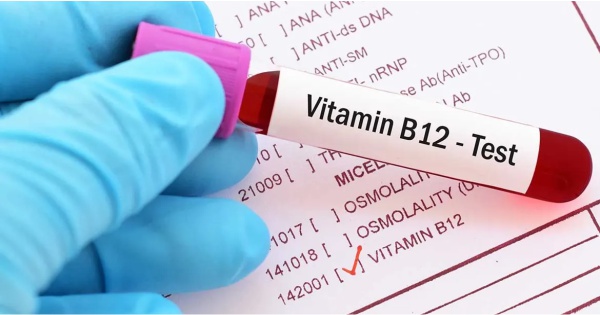 Vitamin B12 test