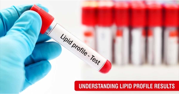 Understanding Lipid Profile results