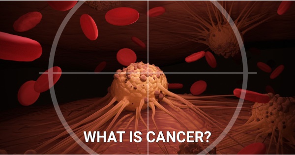 What Is Cancer?