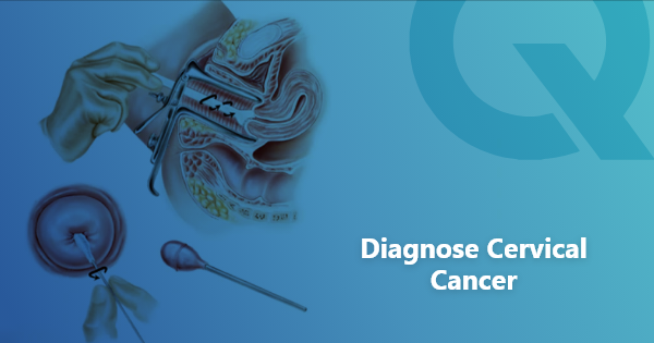 How to diagnose cervical cancer