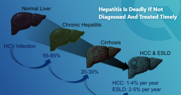 Hepatitis is deadly if not diagnosed and treated timely