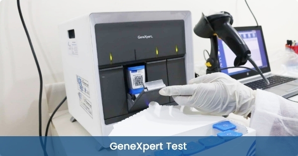 GeneXpert-Test