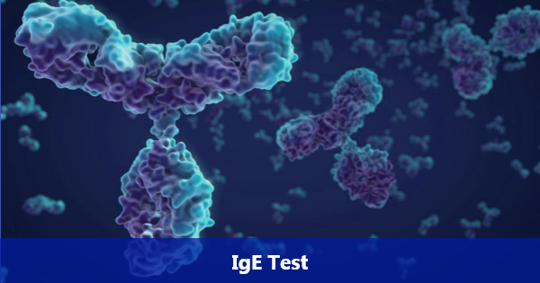 IgE Test: Why it is Done? How IgE Test is Performed?