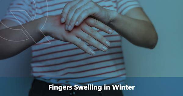 fingers swelling in winter