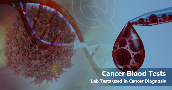 Tests to Diagnose Cancer