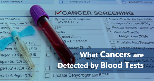 Lab tests used in cancer diagnosis