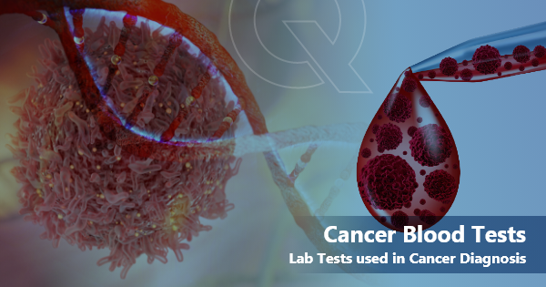 What Cancers are Detected by Blood Tests