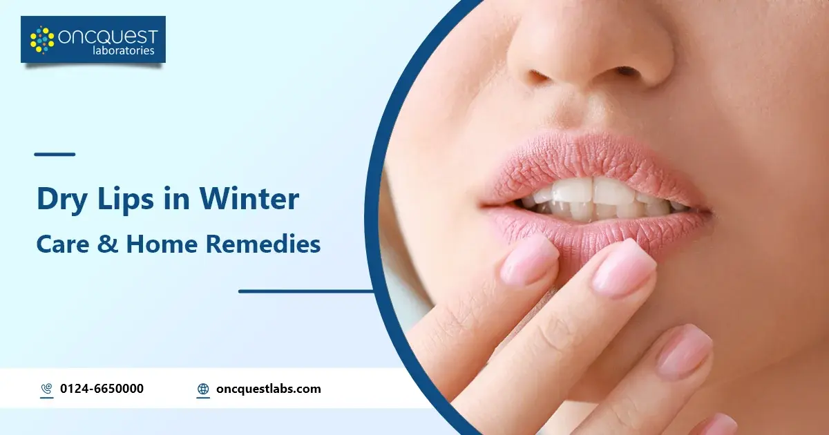 Dry Lips in Winter: Care and Home Remedies
