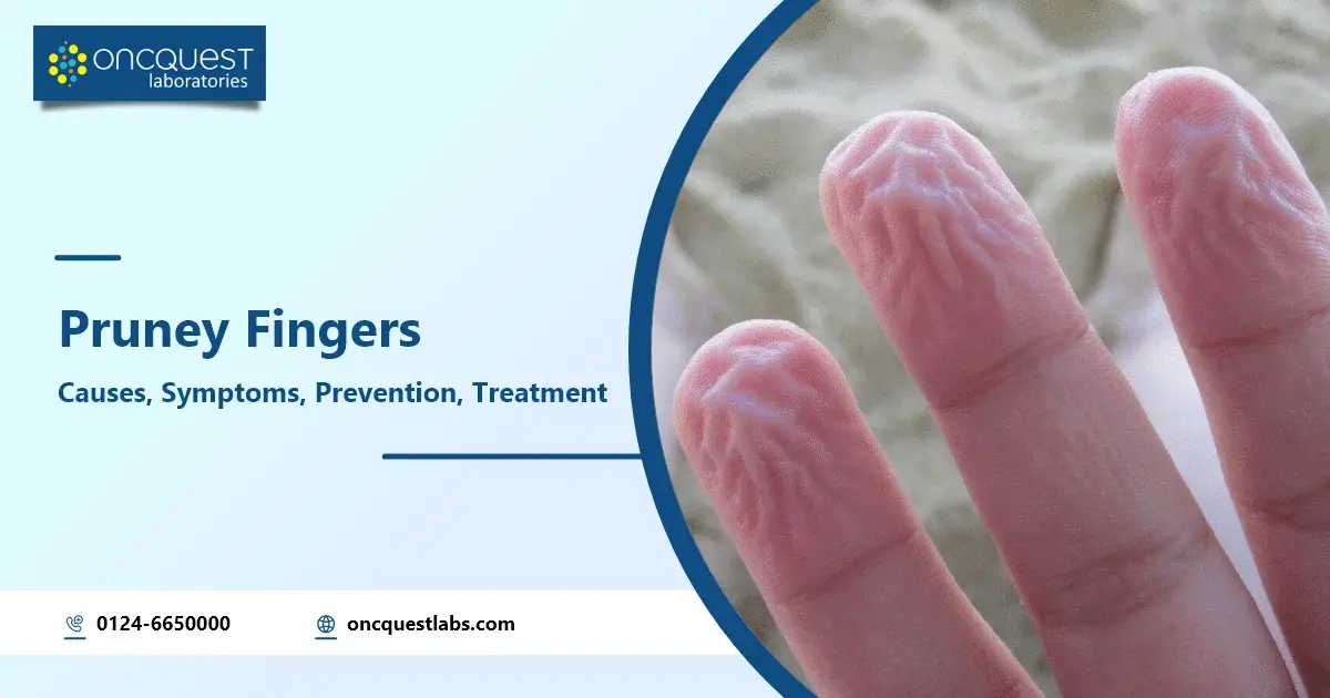 pruney or wrinkled fingers causes symptoms prevention treatment