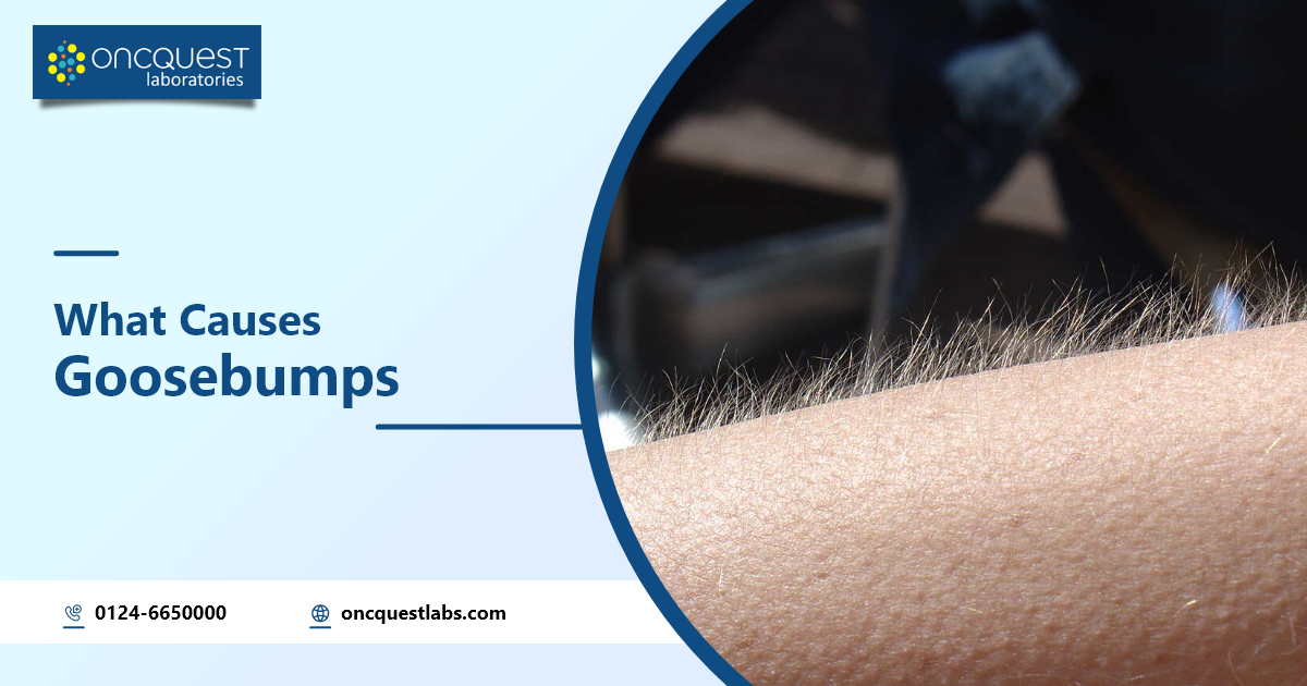 What Causes Goosebumps