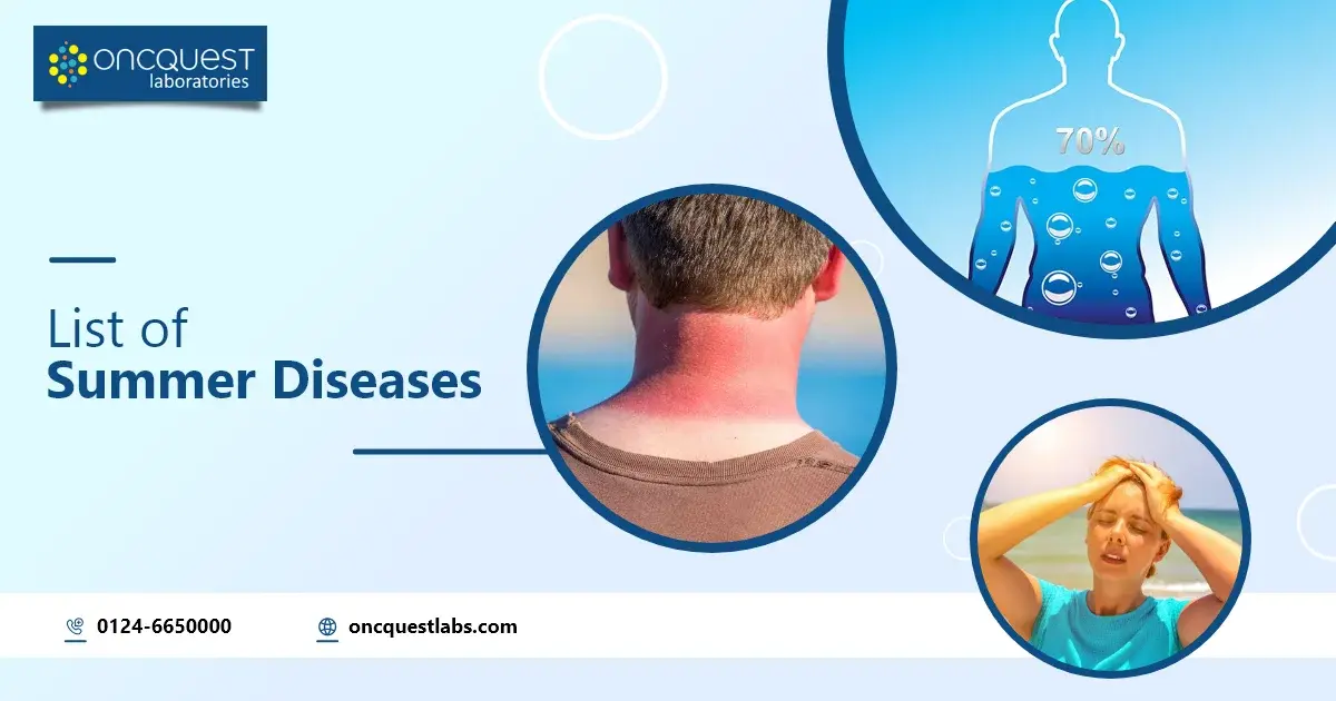 List of Summer Diseases: Beware the Summer Health Hazards