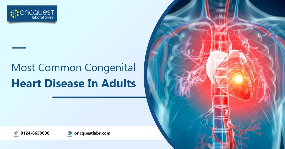 Most Common Congenital Heart Disease In Adults