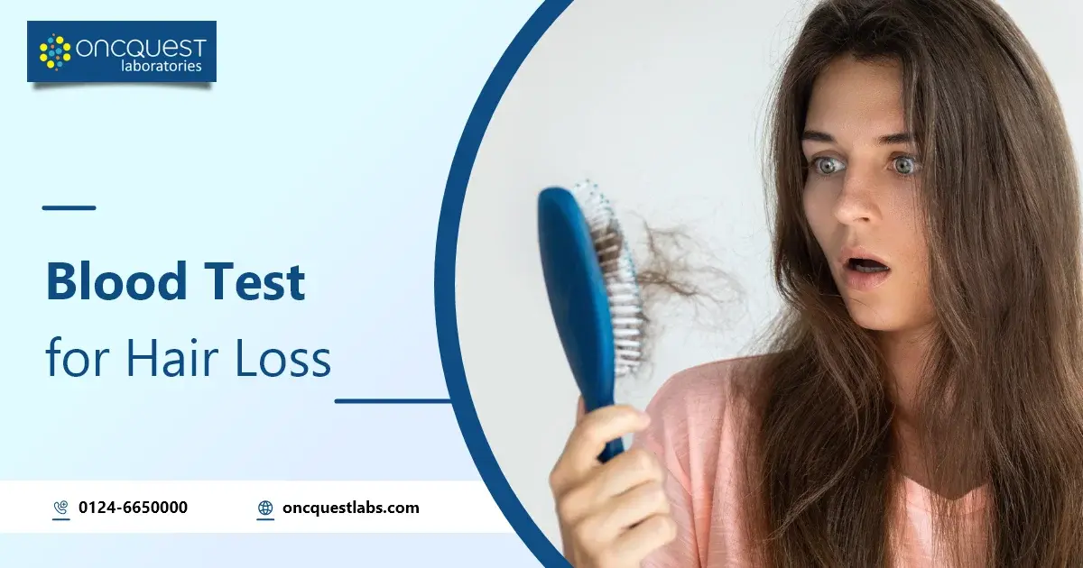 Blood Test for Hair Loss [Male/Female] Oncquest Blog Your Health Guide