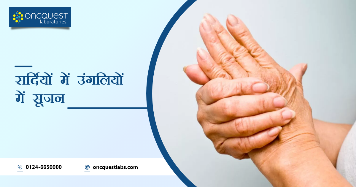 winter fingers swelling in hindi