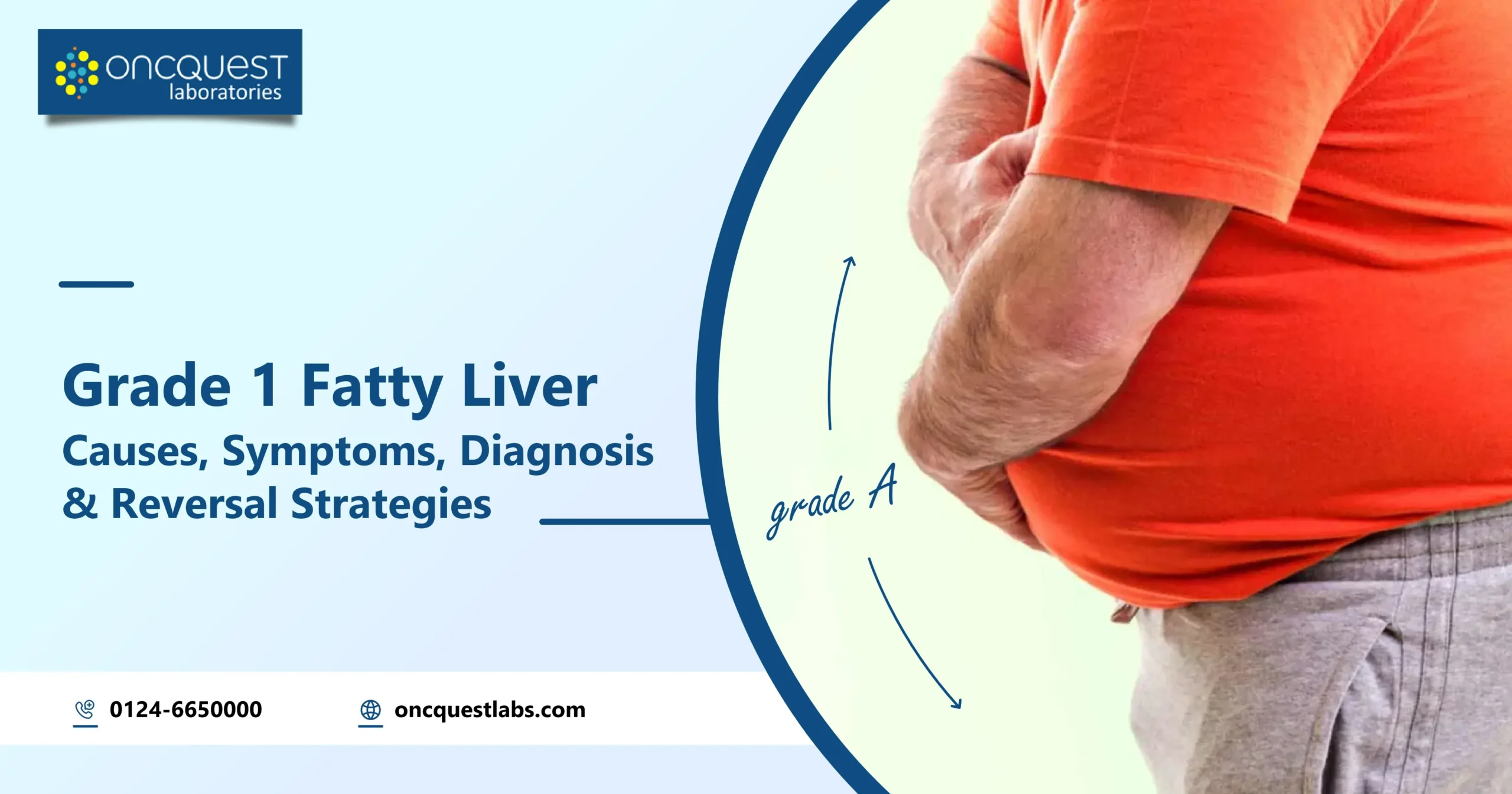 Grade 1 Fatty Liver: Causes, Symptoms, Diagnosis, and Reversal Strategies