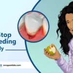 How to Stop Gum Bleeding Immediately