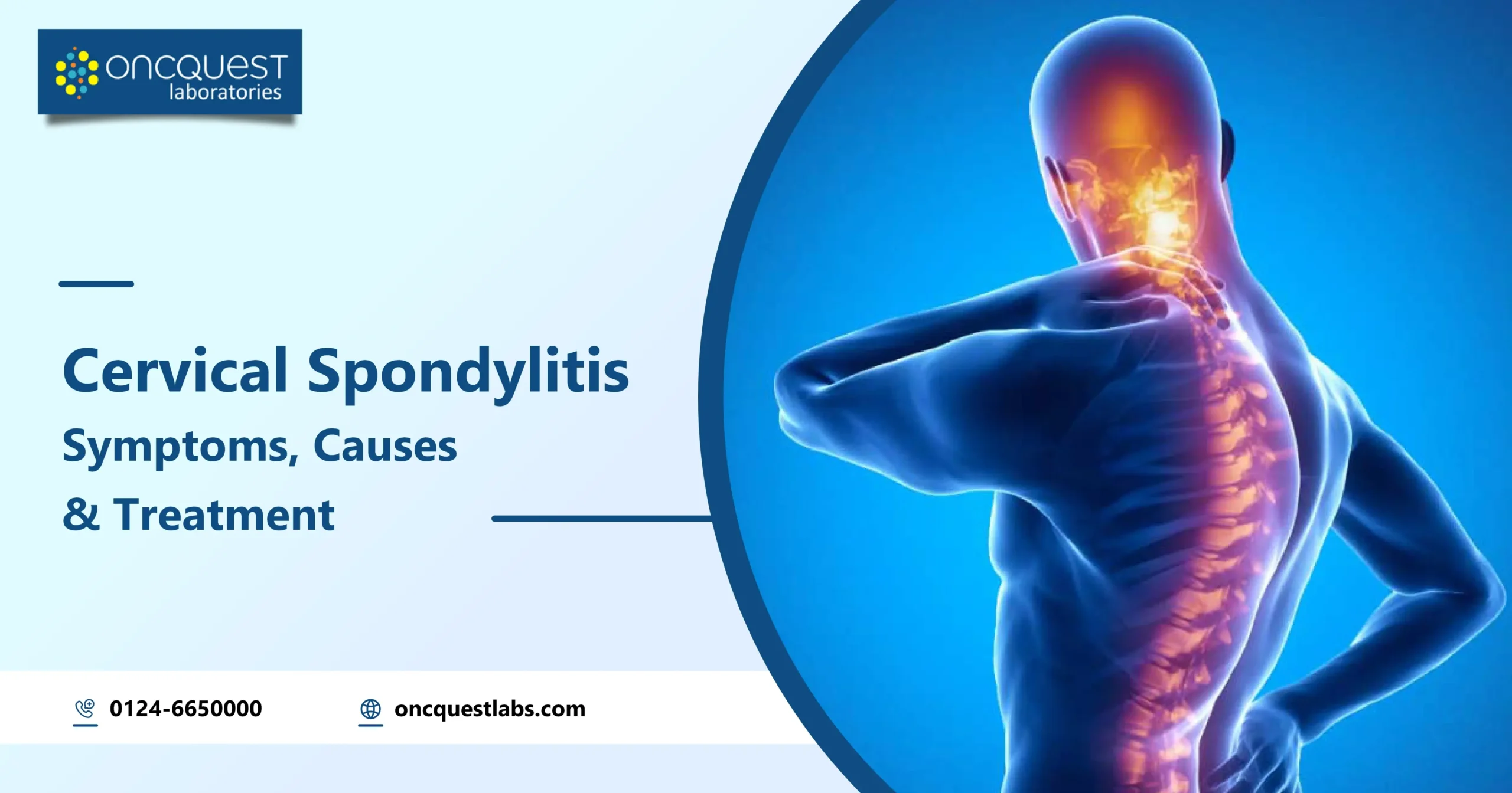 Cervical Spondylitis: Symptoms, Causes and Treatment