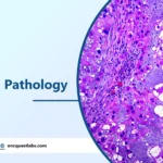 Thymoma Pathology Outlines