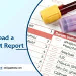 How to Read a Blood Test Report? 