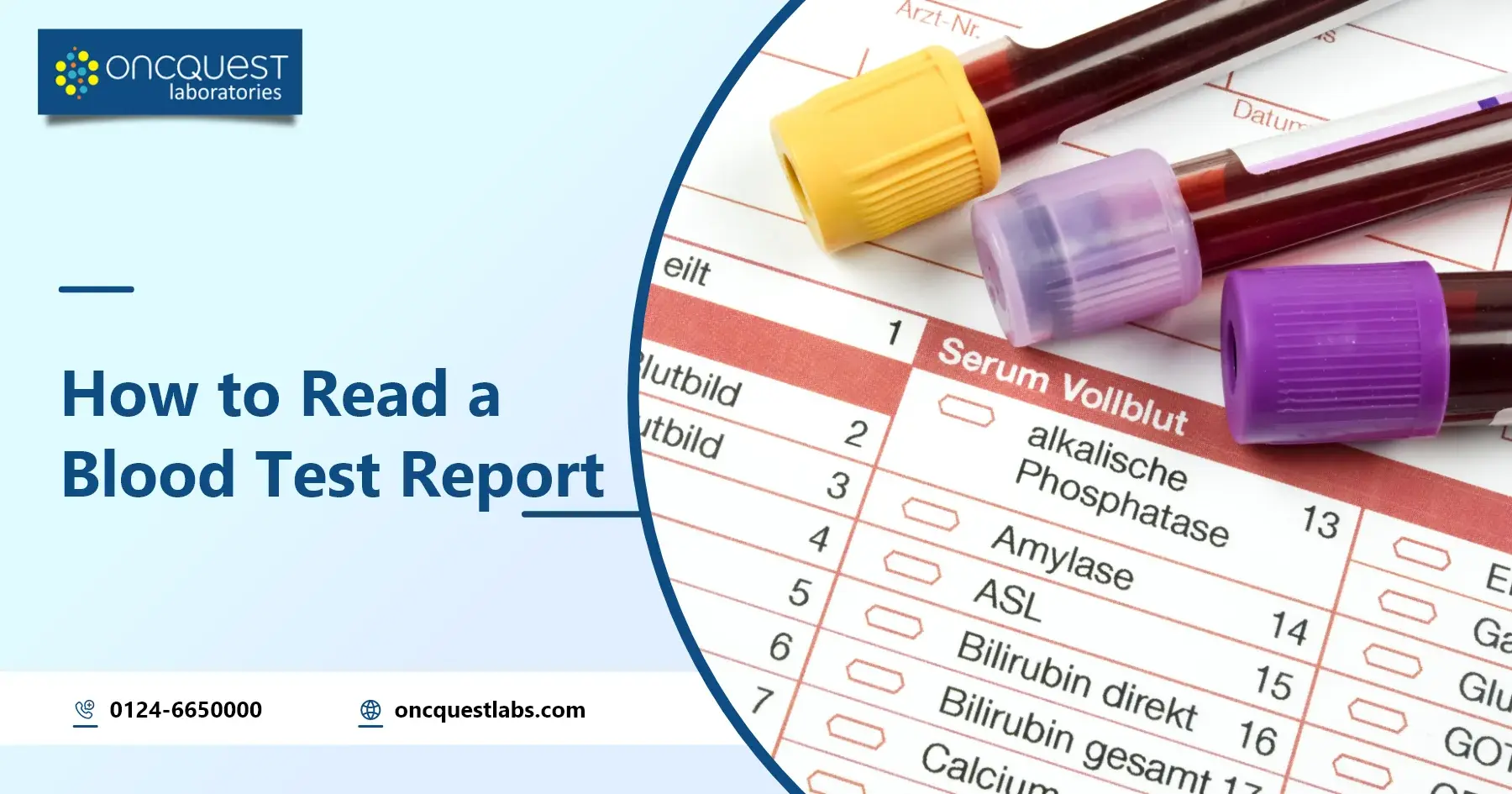 How to Read a Blood Test Report? 