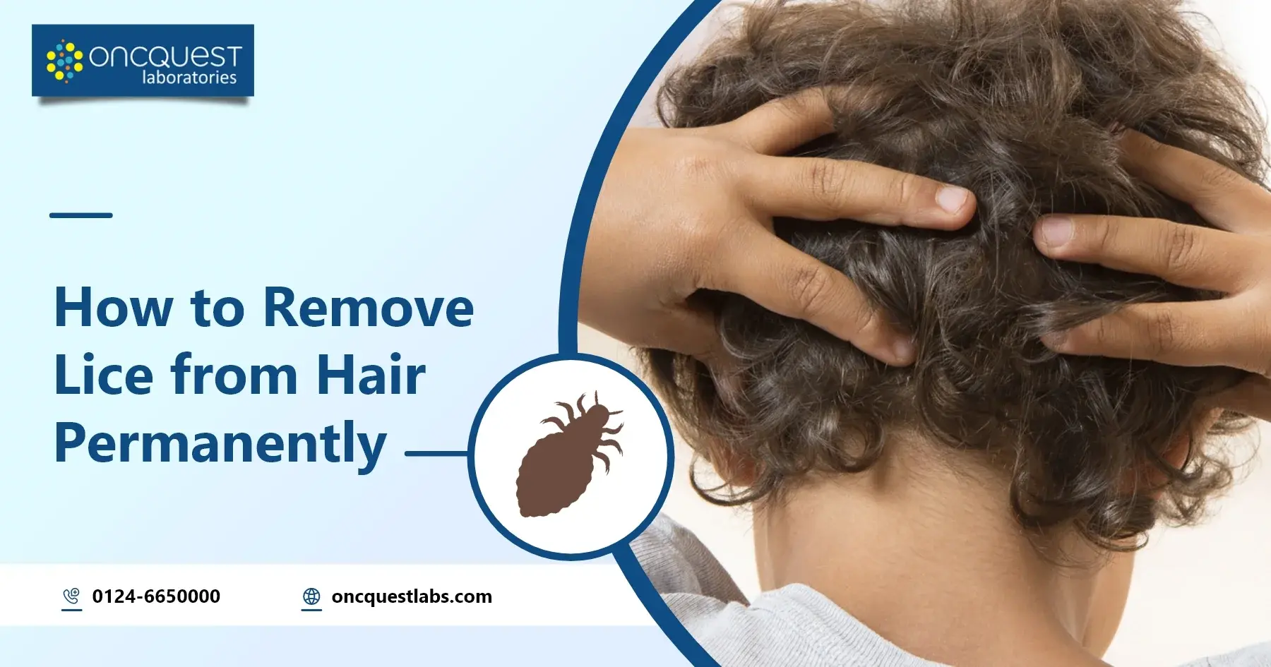 How to Remove Lice from Hair Permanently