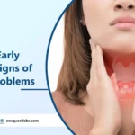 what are early warning signs of thyroid problems