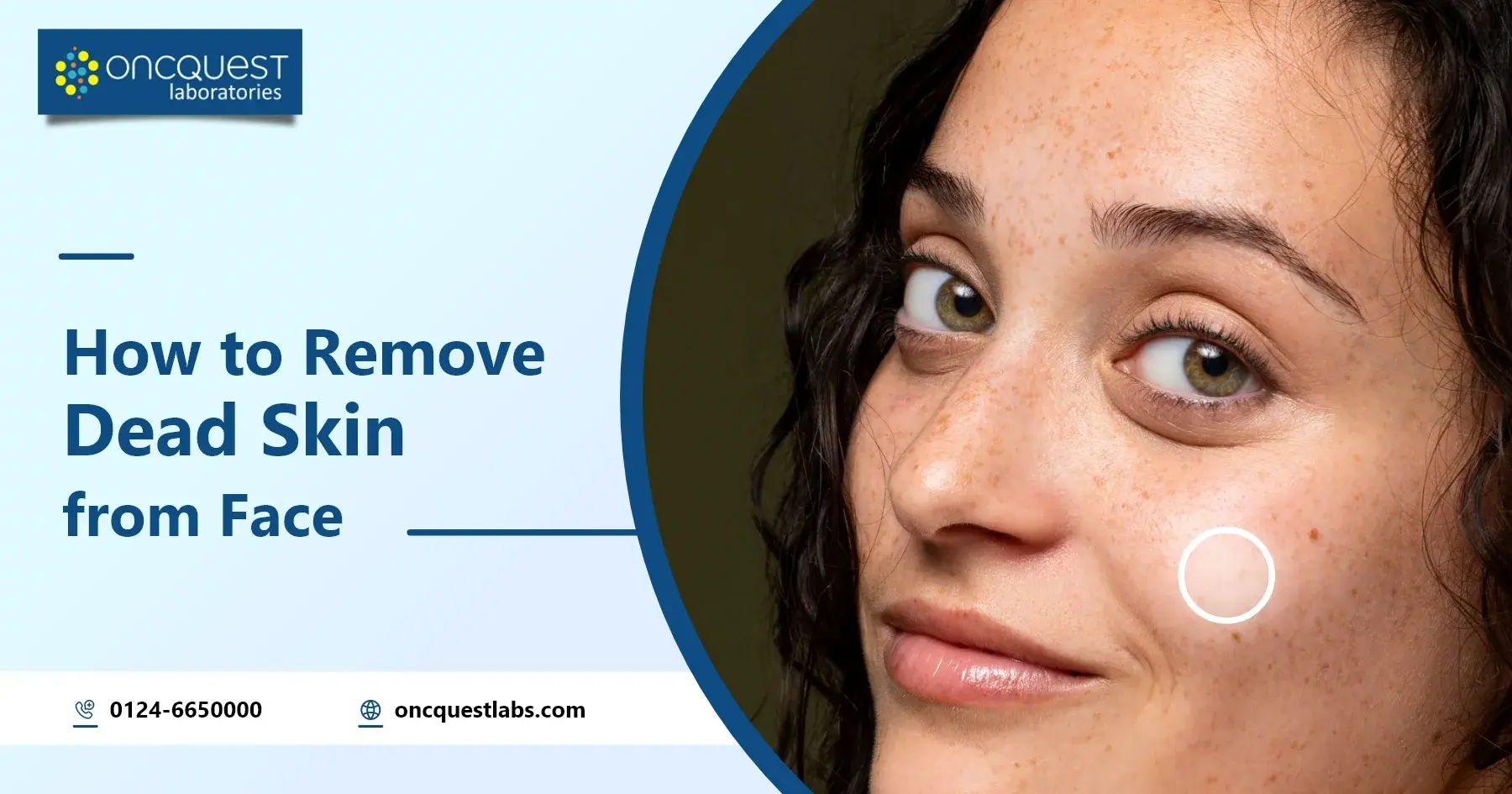 How to Remove Dead Skin from Face?