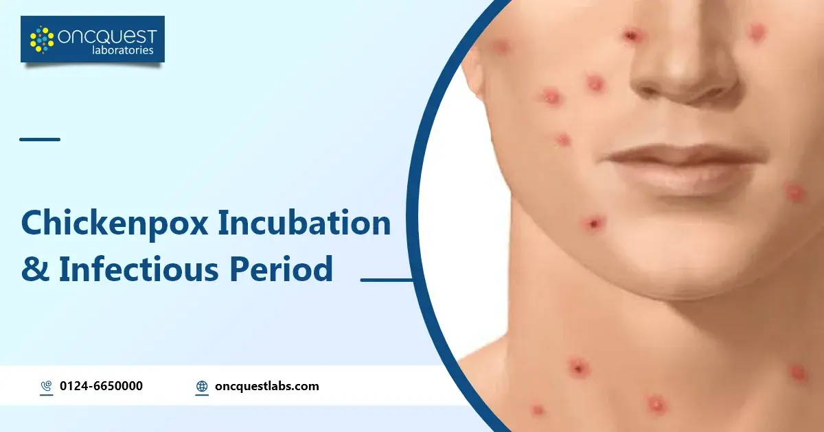 Chickenpox Incubation and Infectious Period