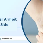 Pain Under Armpit Left Side