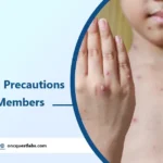 Chickenpox Precautions for Family Members