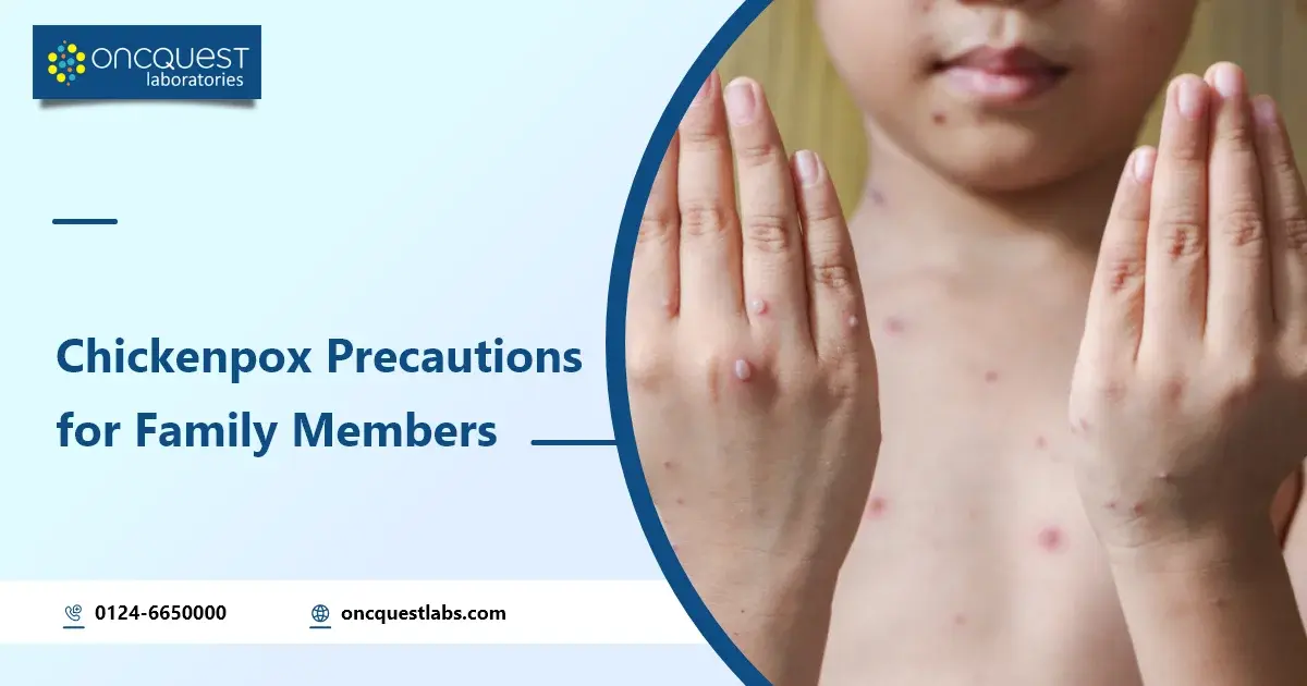 Chickenpox Precautions for Family Members