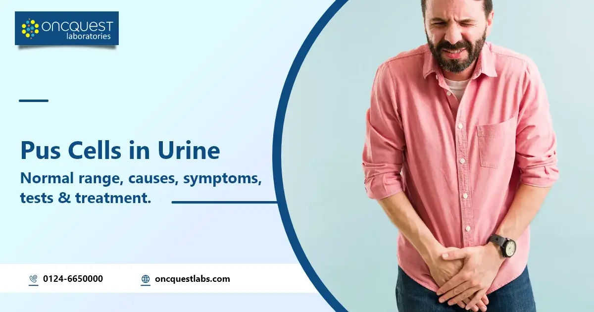 Pus Cells in Urine: Normal Range, Causes, Symptoms, Tests and Treatment