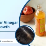 Benefits of Apple Cider Vinegar for Hair Growth